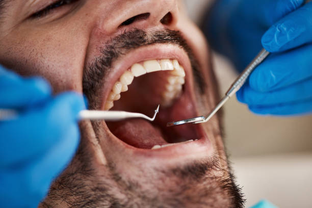  Nevada, MO Emergency Dentist Pros