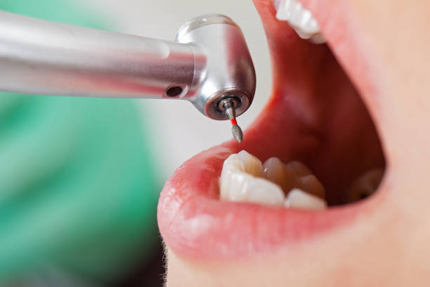 Best Broken or Cracked Tooth Emergency Dentist in Nevada, MO